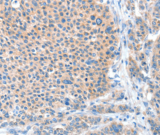 ADAM20 Polyclonal Antibody (E-AB-10731)
