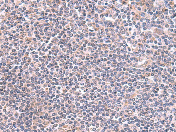 GMDS Polyclonal Antibody (E-AB-19003)