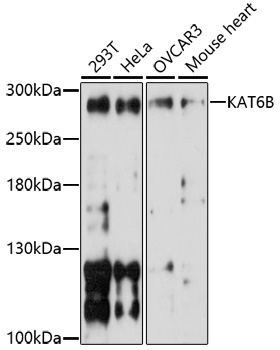 KAT6B Polyclonal Antibody (E-AB-91703)
