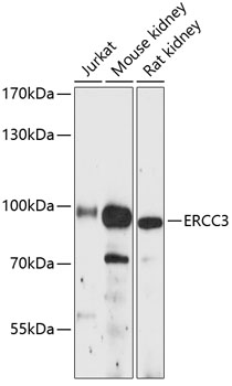 ERCC3 Polyclonal Antibody (E-AB-90457)