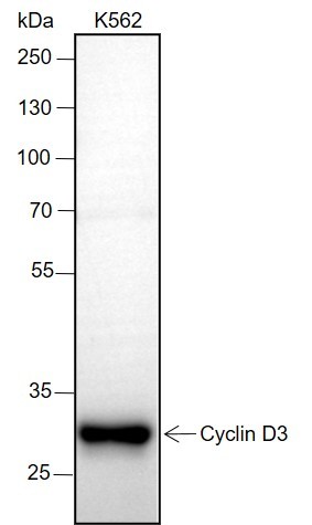 Recombinant Cyclin D3 Monoclonal Antibody (AN301504L)