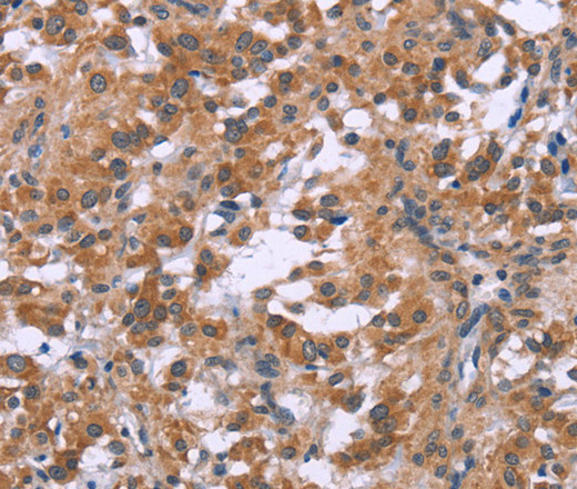 GNPAT Polyclonal Antibody (E-AB-13275)