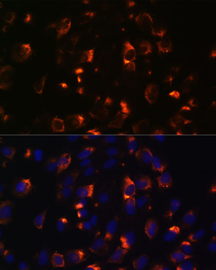 CCDC47 Polyclonal Antibody (E-AB-66608)