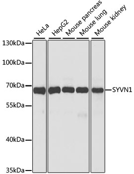 SYVN1 Polyclonal Antibody (E-AB-62548)