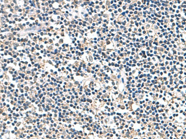 ATP5F1D Polyclonal Antibody (E-AB-53055)