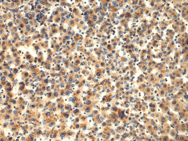 TMOD1 Polyclonal Antibody (E-AB-53173)