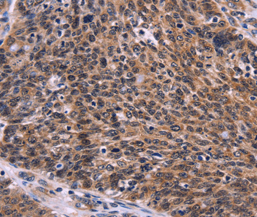 CDC5L Polyclonal Antibody (E-AB-14714)