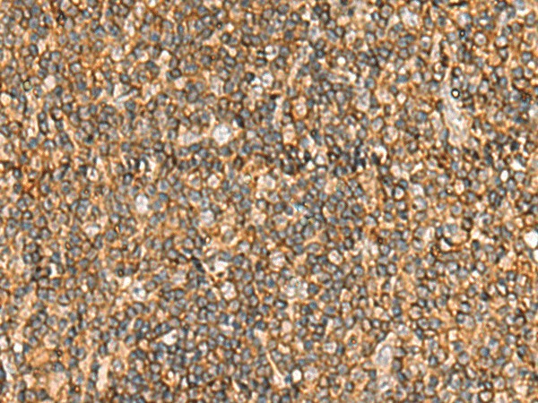 NLRC4 Polyclonal Antibody (E-AB-52183)