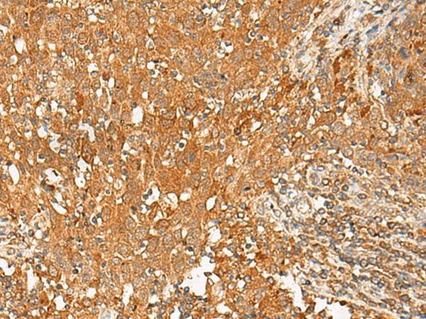 GPR1 Polyclonal Antibody (E-AB-19926)