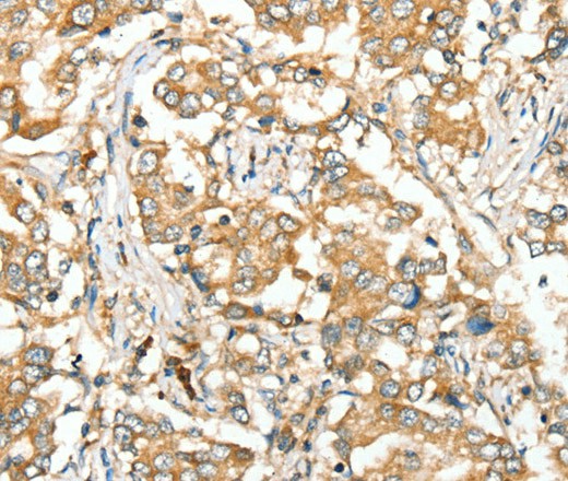 SIRT4 Polyclonal Antibody (E-AB-16821)