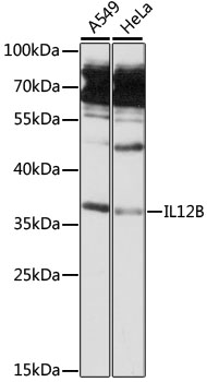 IL12B Polyclonal Antibody (E-AB-90554)