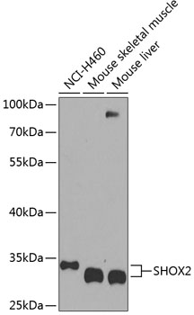 SHOX2 Polyclonal Antibody (E-AB-62214)