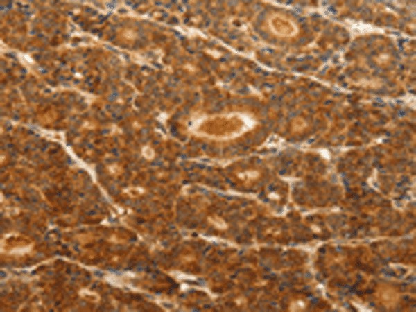 CDH5 Polyclonal Antibody (E-AB-53193)