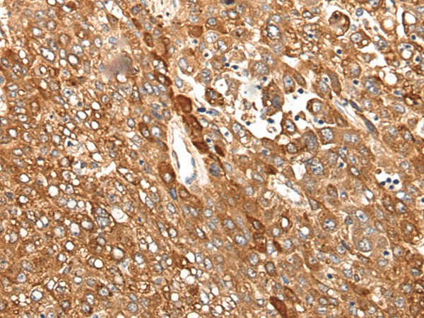 CAD Polyclonal Antibody (E-AB-17759)