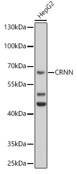 CRNN Polyclonal Antibody (E-AB-92910)