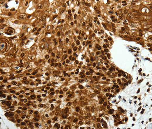 SCN1A Polyclonal Antibody (E-AB-12858)