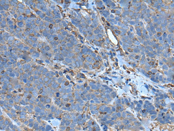 SLC24A5 Polyclonal Antibody (E-AB-53331)