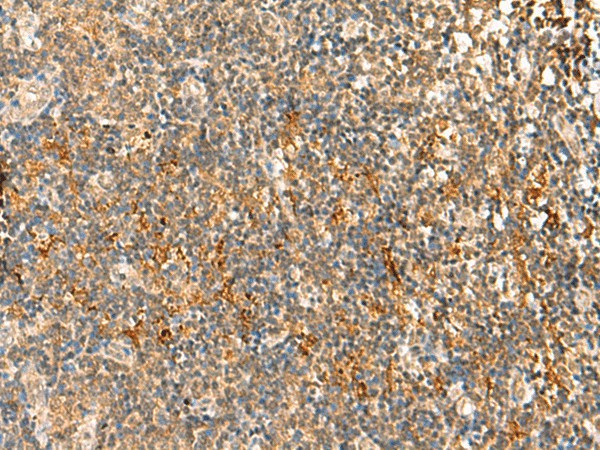 HTT Polyclonal Antibody (E-AB-52008)