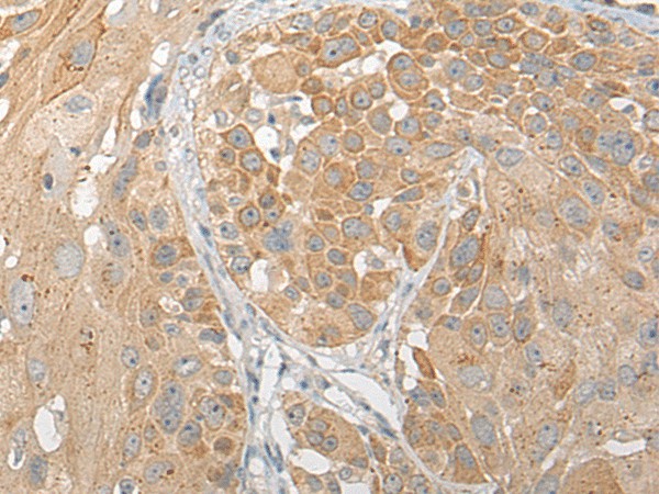SNX6 Polyclonal Antibody (E-AB-19763)