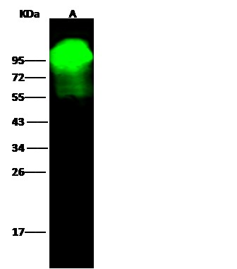 Recombinant Alkaline Phosphatase/ALPL Monoclonal Antibody (AN300089P)