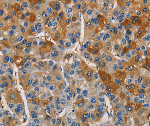 CST4 Polyclonal Antibody (E-AB-14715)