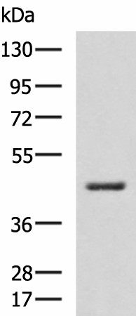 HSD3B2 Polyclonal Antibody (E-AB-19259)