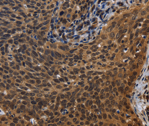 FHL3 Polyclonal Antibody (E-AB-15038)
