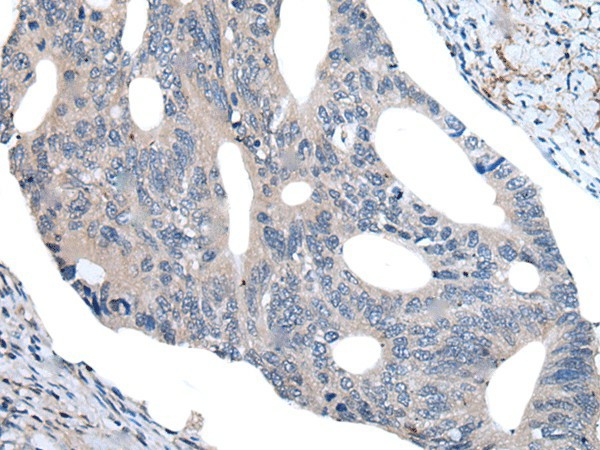 UBR4 Polyclonal Antibody (E-AB-19599)