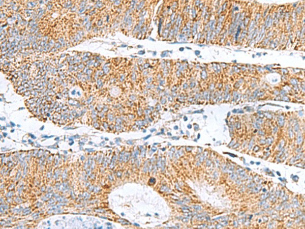 GCSH Polyclonal Antibody (E-AB-53060)
