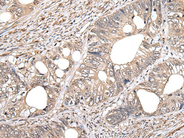 GCNT2 Polyclonal Antibody (E-AB-18360)