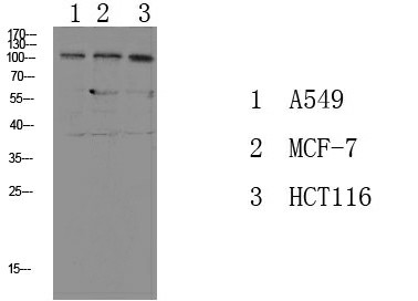 Phospho-Na+/K+-ATPase alpha1 (Tyr260) Polyclonal Antibody (E-AB-51060)