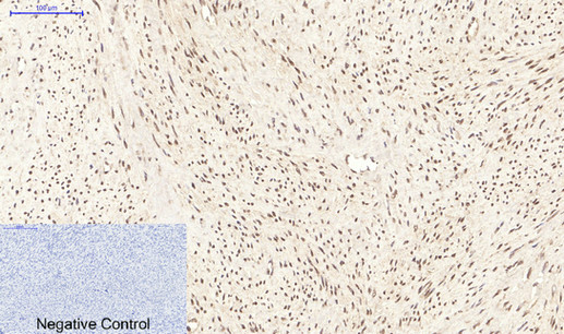 PPARD Monoclonal Antibody (E-AB-22126)