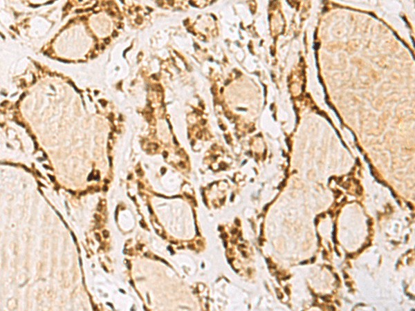 NIPBL Polyclonal Antibody (E-AB-18915)