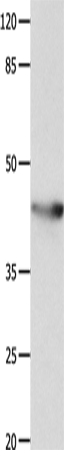 KCNA5 Polyclonal Antibody (E-AB-14174)