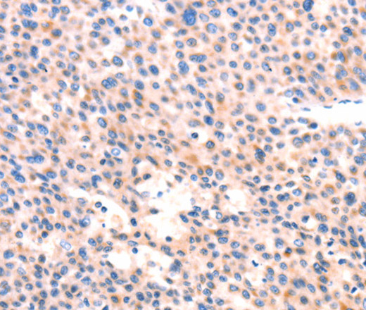 APBA2 Polyclonal Antibody (E-AB-12975)