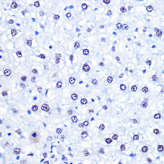 CHD4 Polyclonal Antibody (E-AB-63554)