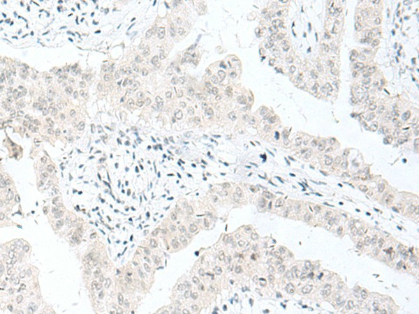 ENSA Polyclonal Antibody (E-AB-52798)
