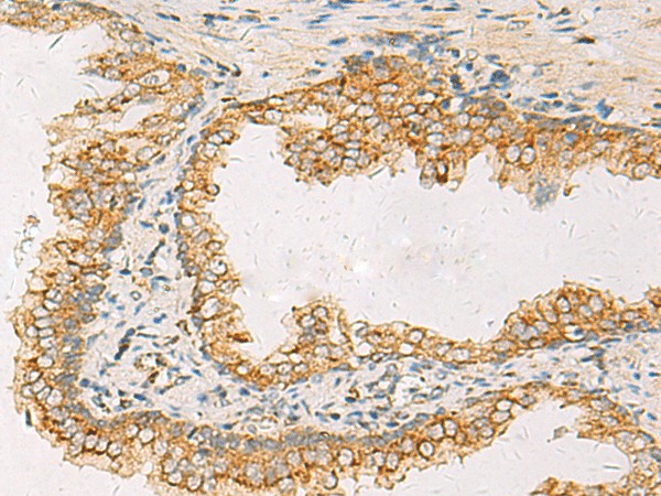 SUSD3 Polyclonal Antibody (E-AB-53121)