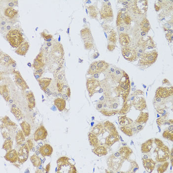 HDAC4 Polyclonal Antibody (E-AB-63997)