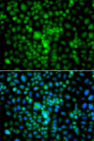 CIDEA Polyclonal Antibody (E-AB-62677)