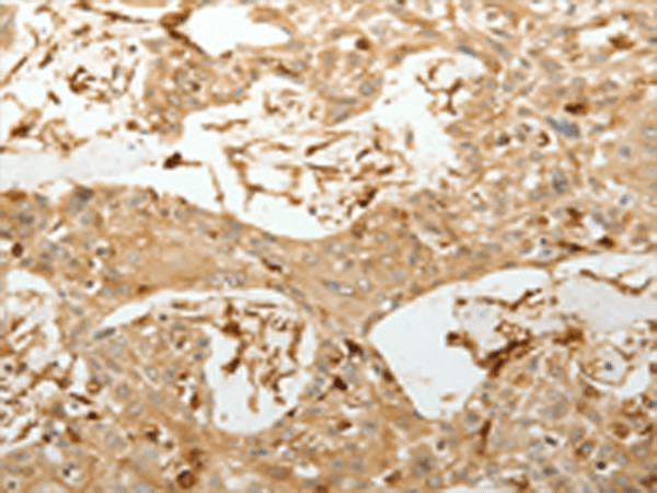 VMA21 Polyclonal Antibody (E-AB-53204)