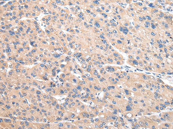 VAMP4 Polyclonal Antibody (E-AB-17243)