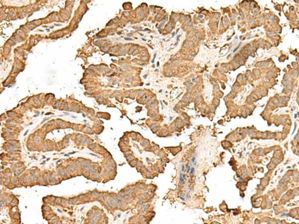 RPS25 Polyclonal Antibody (E-AB-52683)