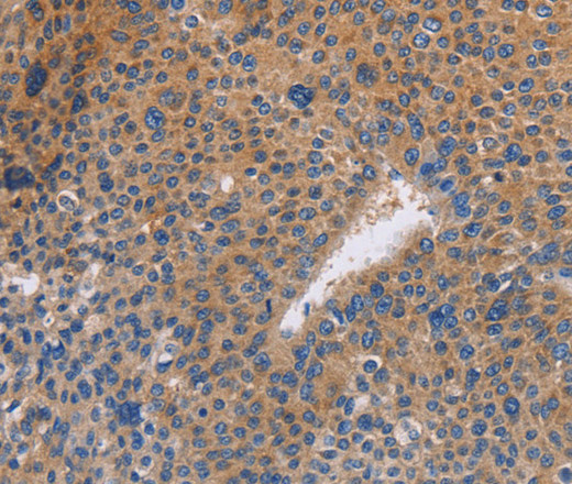 NEK8 Polyclonal Antibody (E-AB-14701)