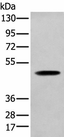 SERPINH1 Polyclonal Antibody (E-AB-19472)