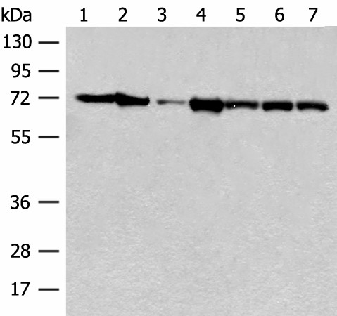 HSPA2 Polyclonal Antibody (E-AB-52655)