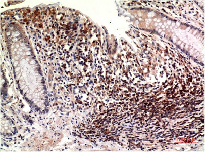 epsilon Tubulin Monoclonal Antibody (E-AB-22237)