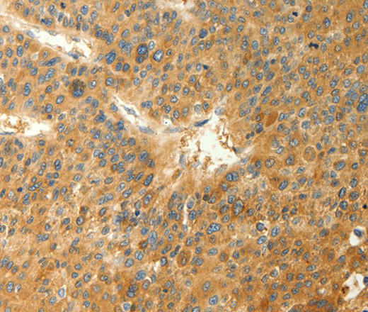 RAB35 Polyclonal Antibody (E-AB-15468)