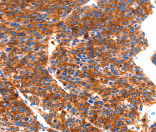 SEPT4 Polyclonal Antibody (E-AB-16226)