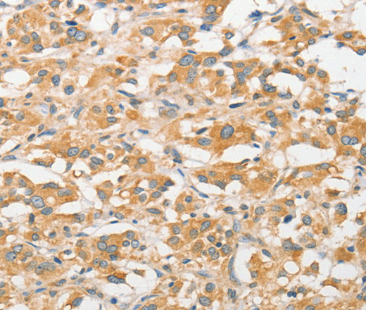 TLR5 Polyclonal Antibody (E-AB-14647)